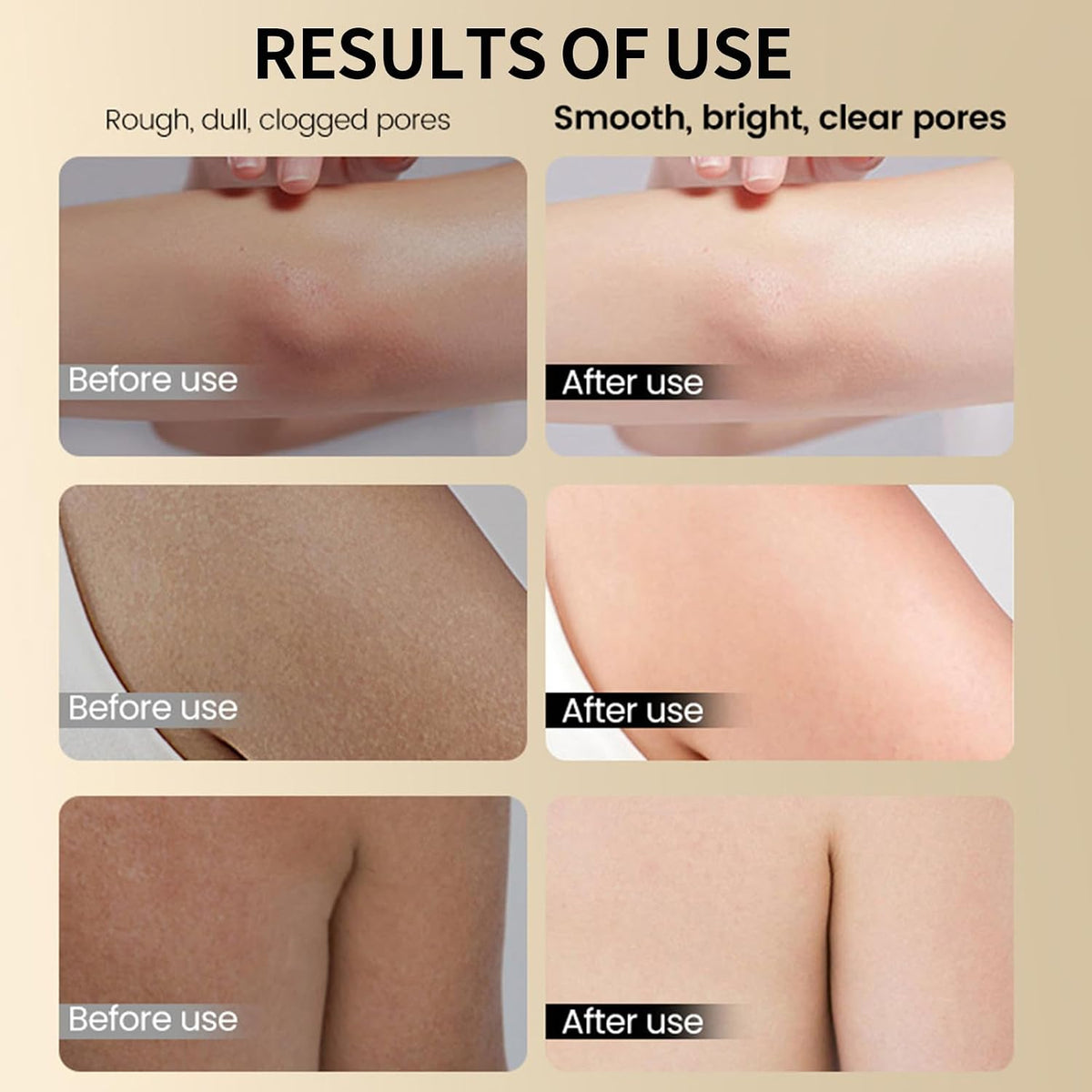 Glycolic Acid Exfoliating Body Stick, Glycolic Acid Stick for Gentle Exfoliation, Smooths Rough Texture, Boosts Radiant Glow, Body Care Balm for Underarms Legs & Full Body, 2.65 Oz